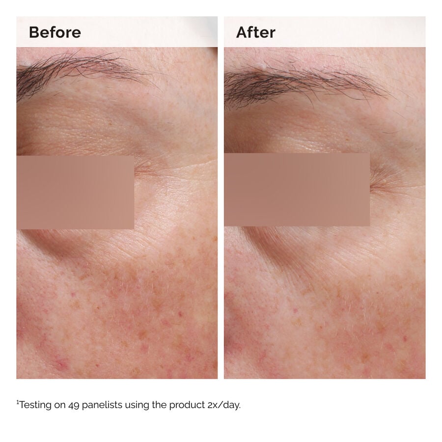 niacinamide-5-face-and-body-emulsion-q7 2024-08-23-ORD-Nia-5pct-Face-Body-B-A-Elasticity-Global-02-1x1.jpg