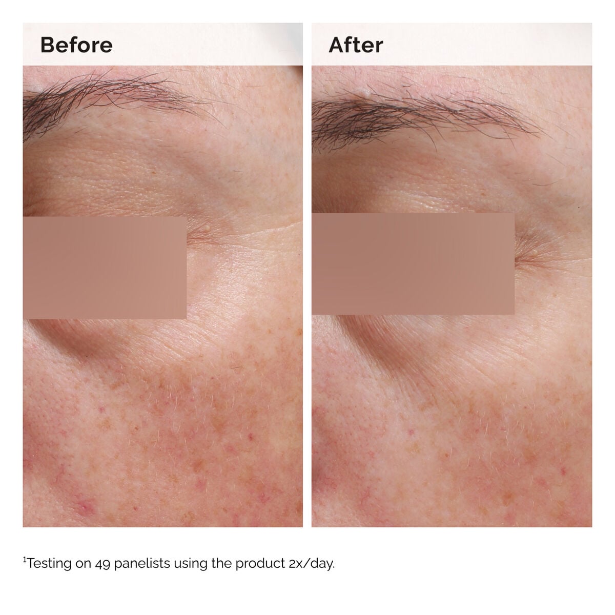 niacinamide-5-face-and-body-emulsion-q7 2024-08-23-ORD-Nia-5pct-Face-Body-B-A-Elasticity-Global-02-1x1.jpg