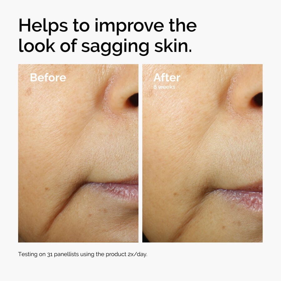 caffeine-3-escin-1-face-serum-e1 ord-caffeine-3pct-escin-1pct-face-serum-before-after-sagging.jpg