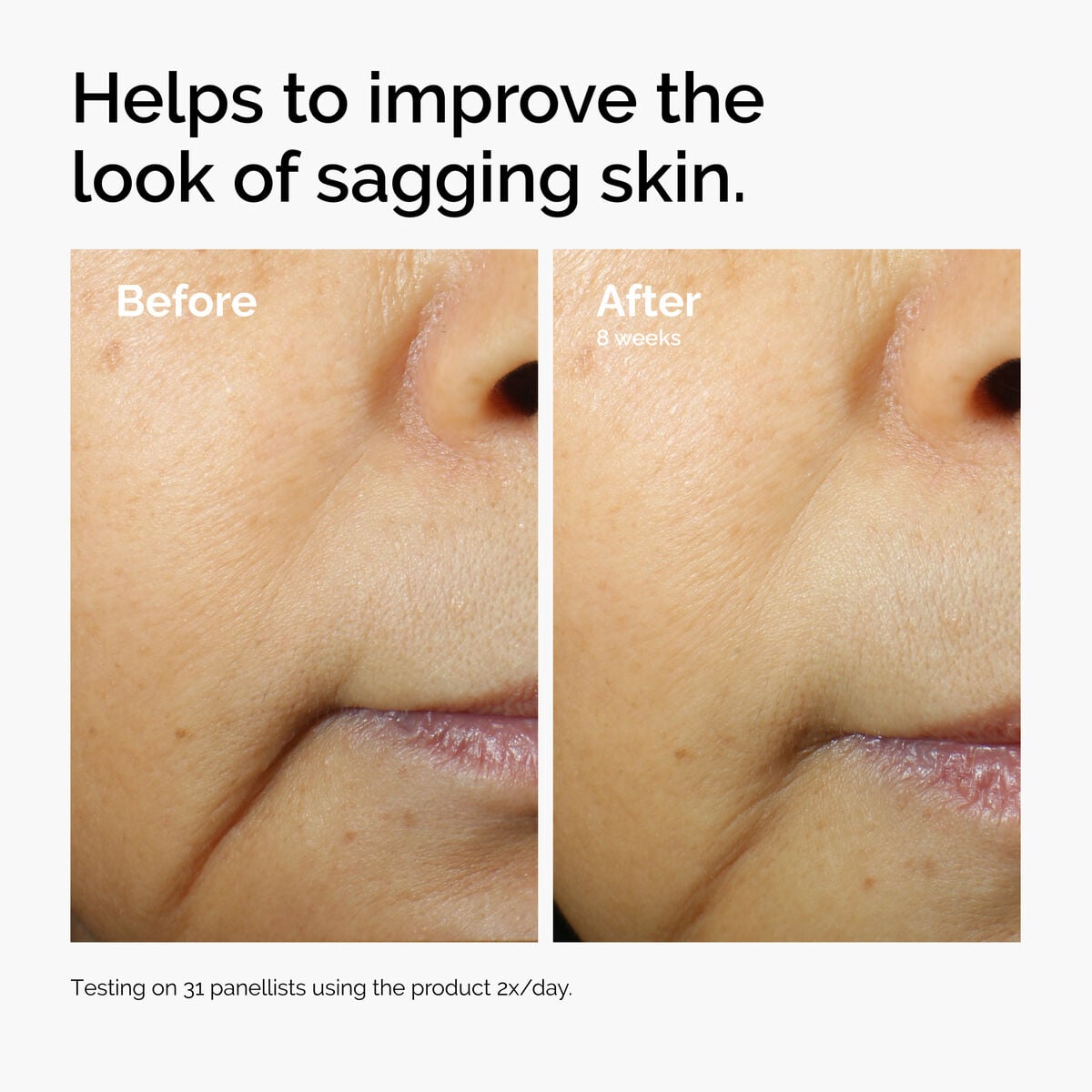 caffeine-3-escin-1-face-serum-e1 ord-caffeine-3pct-escin-1pct-face-serum-before-after-sagging.jpg