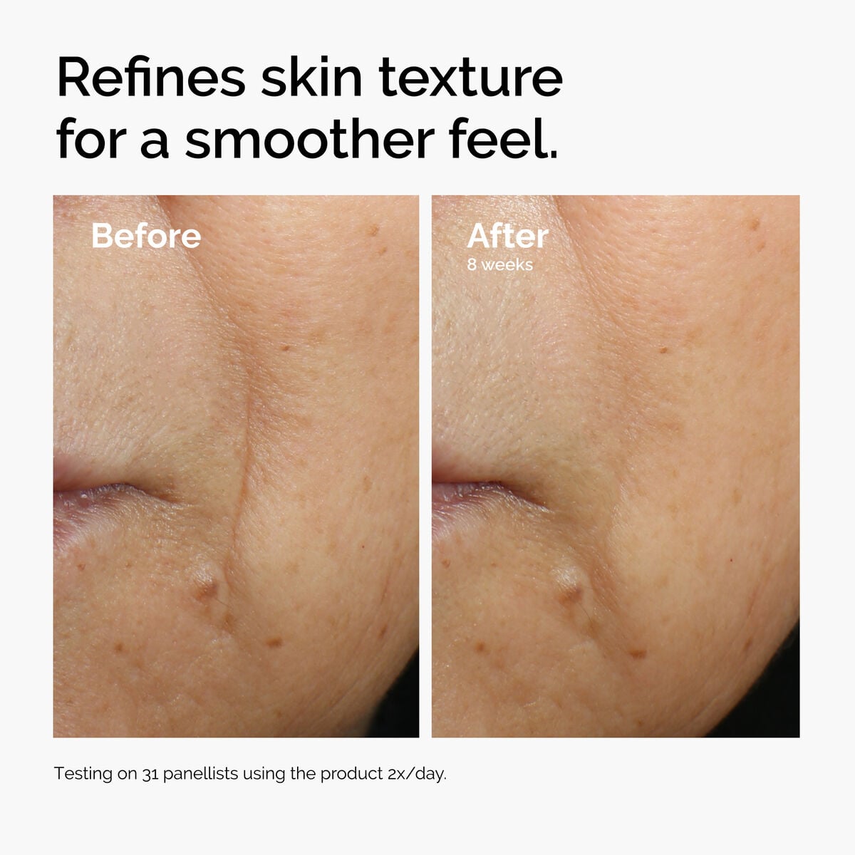 caffeine-3-escin-1-face-serum-e1 ord-caffeine-3pct-escin-1pct-face-serum-before-after-texture.jpg