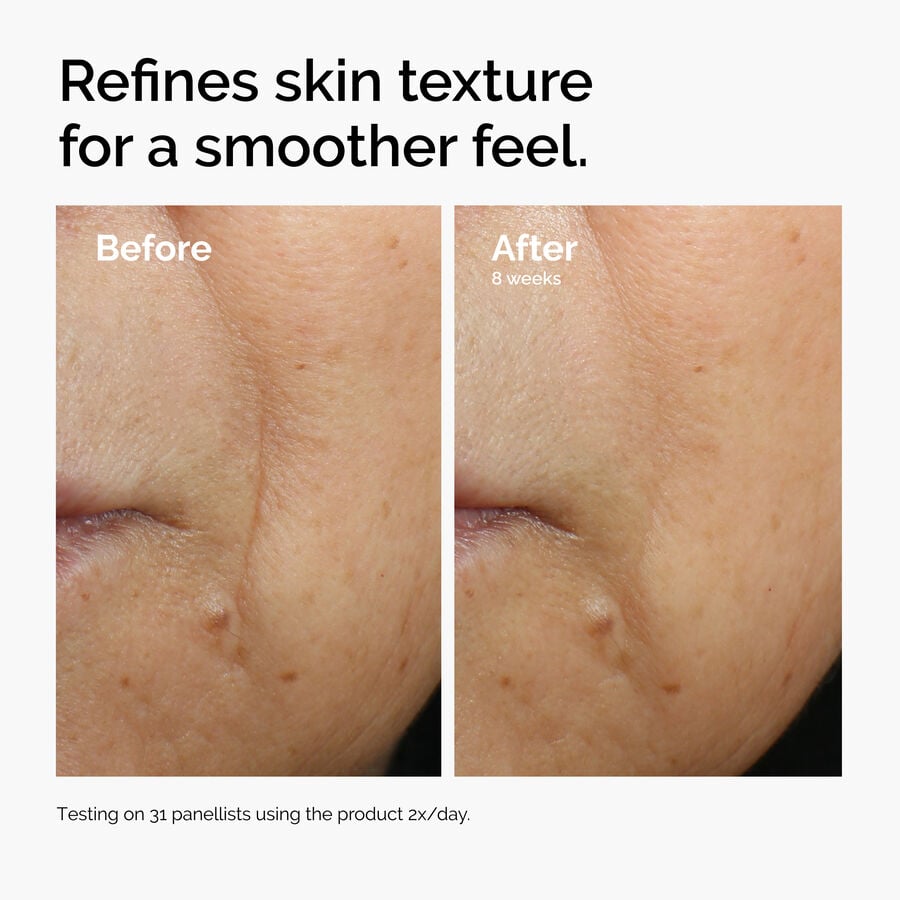 caffeine-3-escin-1-face-serum-e1 ord-caffeine-3pct-escin-1pct-face-serum-before-after-texture.jpg