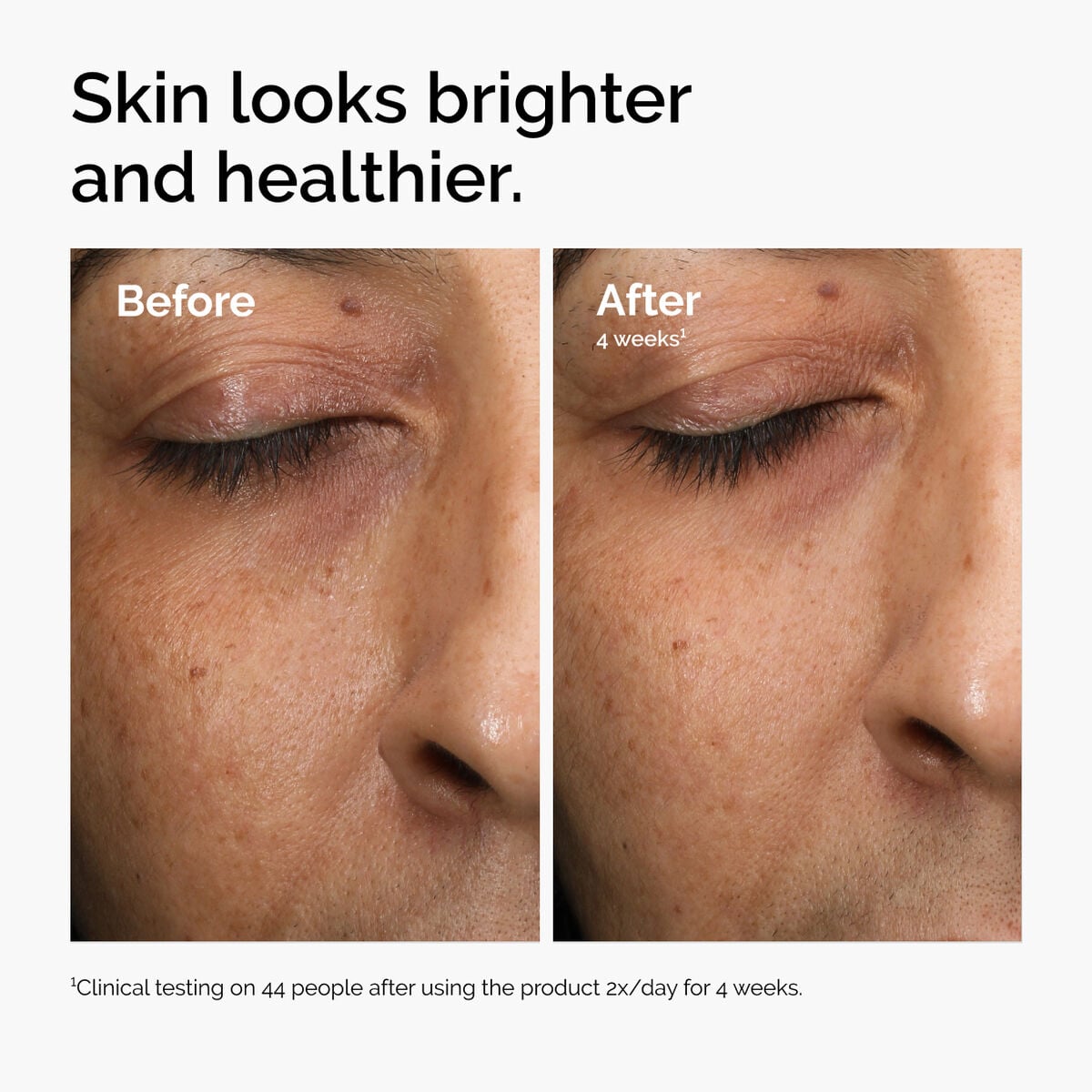 multi-antioxidant-radiance-serum-e8 ord-mars-before-after-healthy.jpg
