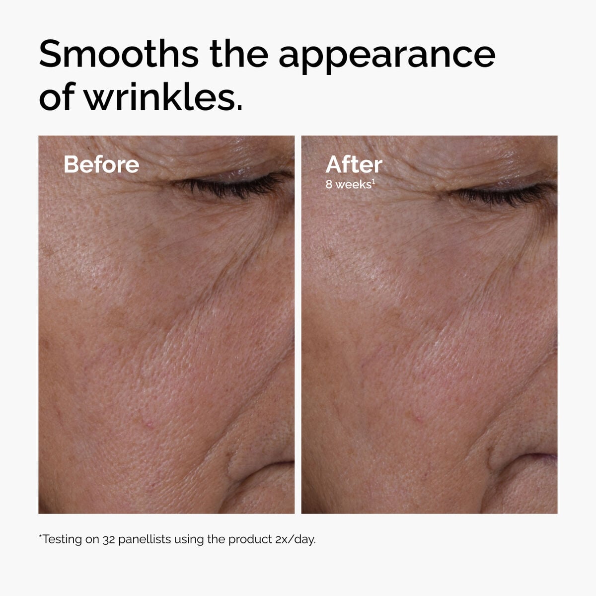 multi-peptide-ha-serum-j7 ord-multi-peptide-ha-serum-wrinkles-before-after.jpg