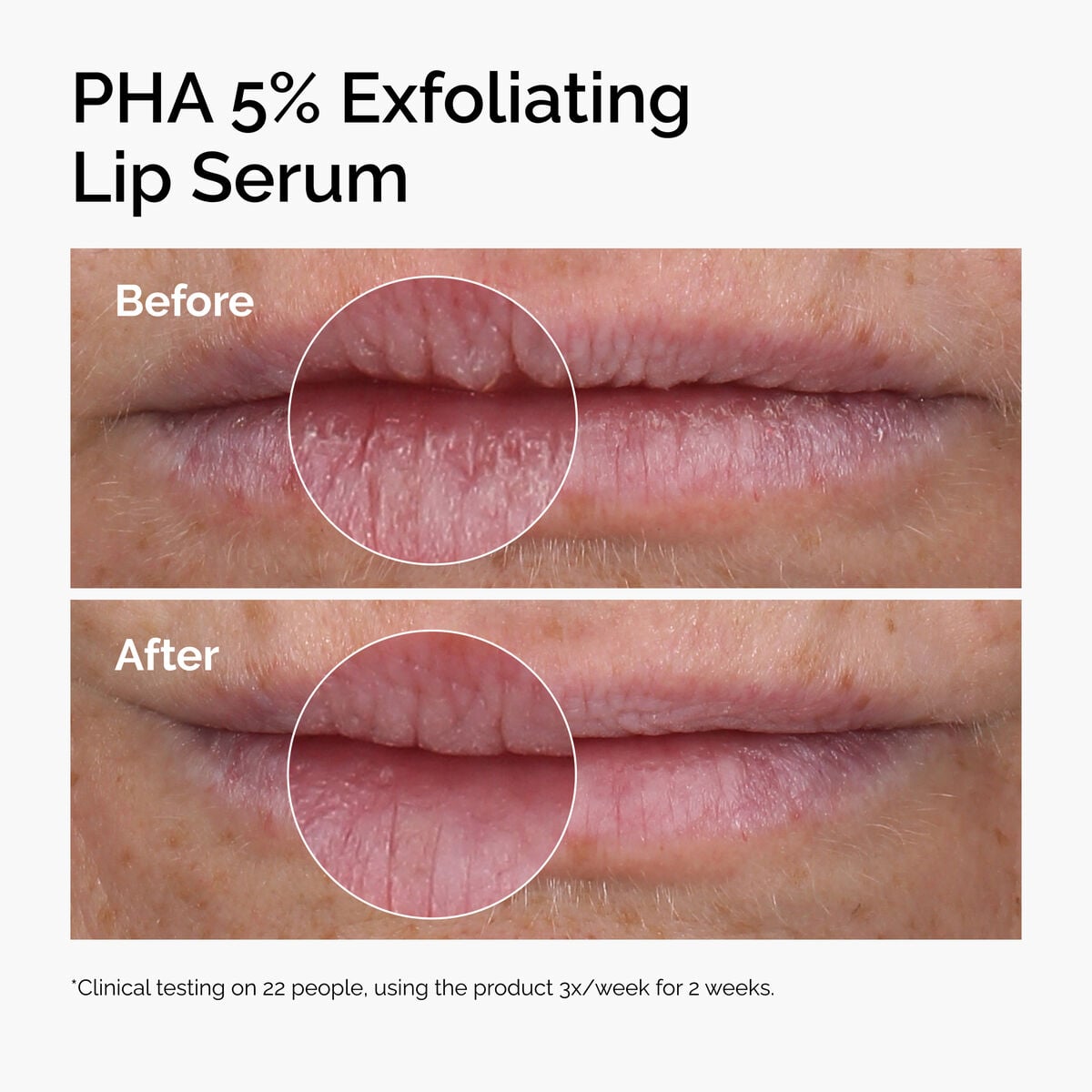 pha-5-exfoliating-lip-serum-r6 ord-pha-5pct-lip-exfoliating-serum-before-after.jpg