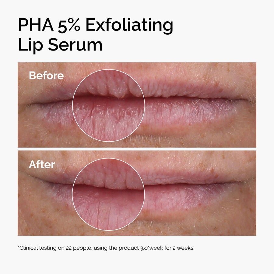 pha-5-exfoliating-lip-serum-r6 ord-pha-5pct-lip-exfoliating-serum-before-after.jpg
